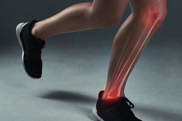 prévention blessure Suivi Accompagnement inflammation, tendinite, blessure , douleurs, soigner par naturopathie